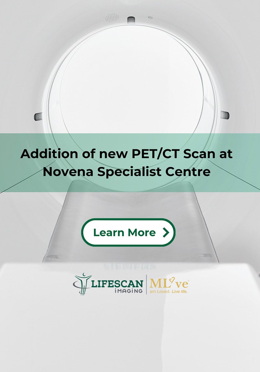 PET Scan mobile